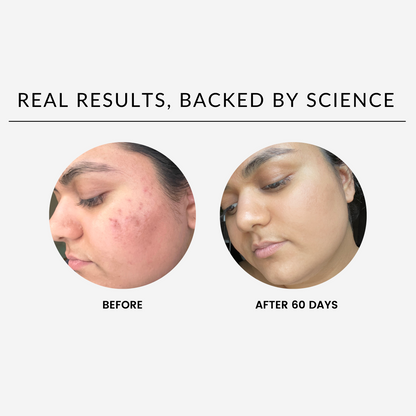 Overnight Glow Up Skincare | Diesel Diamond